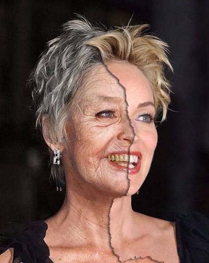 OR BEFORE AFTER YOU DECIDE sharonstone anemijpg